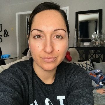 From_Tips_to_Toes_Southington_Chemical_Peel_Testimonial